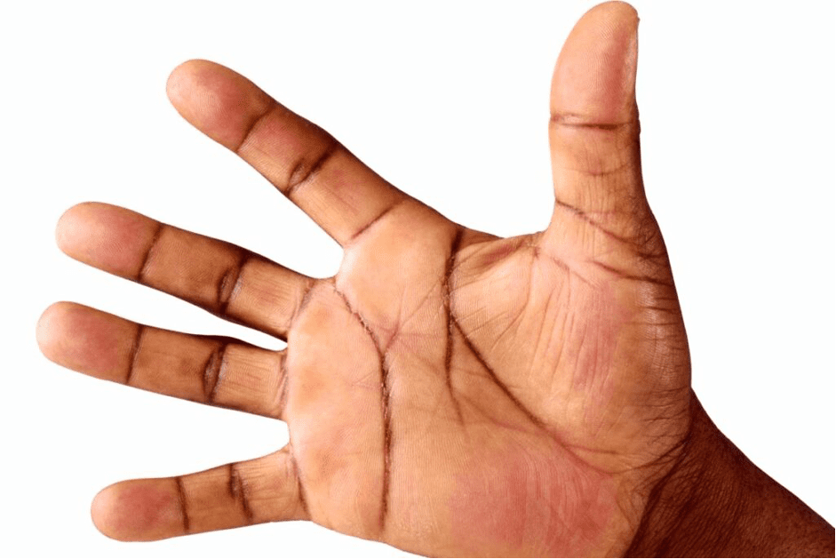 <strong>AKALAKAM: </strong>My palm and my destiny 6 AKALAKAM 1